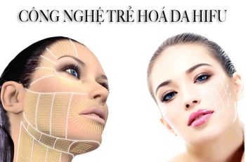 HIFU - Nâng cơ trẻ hóa
