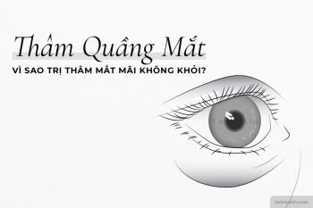 VÌ SAO TỐN TIỀN TRỊ THÂM QUẦNG MẮT VẪN KHÔNG HIỆU QUẢ